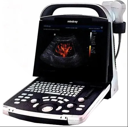 Electronic Ultrasound Machine